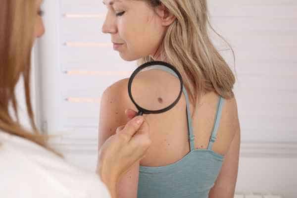 What Are Traditional Skin Lesion Removal Methods Lancashire?