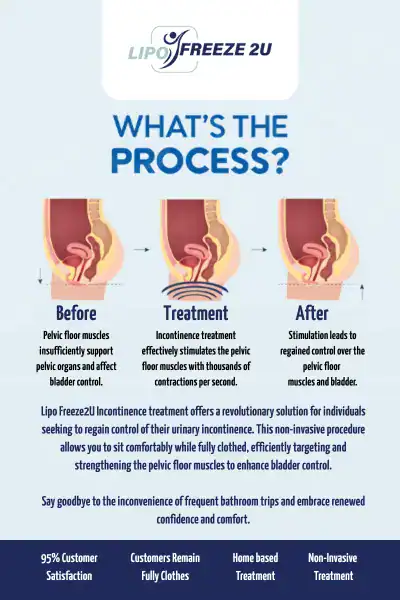 Diagram of how incontinence treatment Lancashire works.