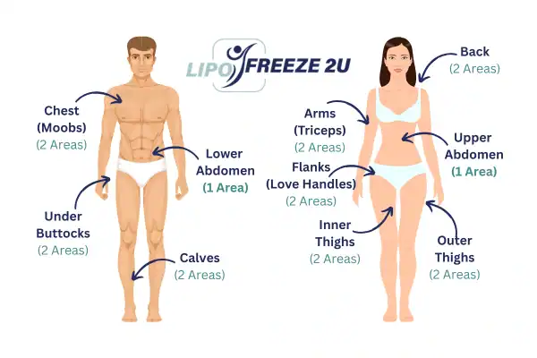 Areas you can have fat freezing treatment Lancashire