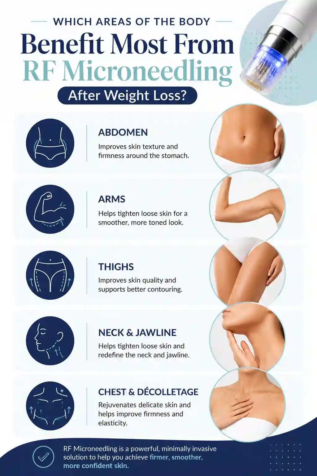 Which Areas of the Body Benefit Most From RF Microneedling After Weight Loss Lancashire